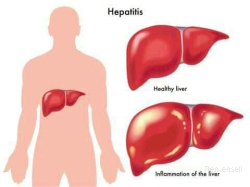 FOREVER LIVING PRODUCTS FOR HEPATITIS B